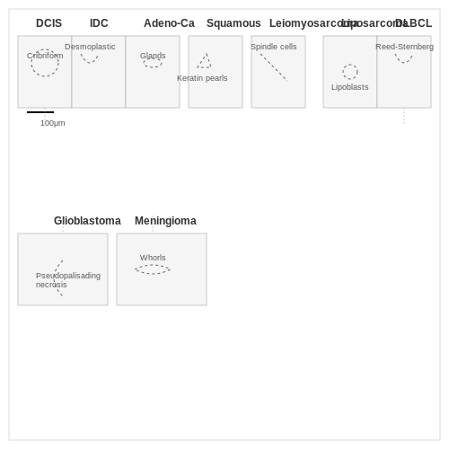 Types of Cancer Detectable via Histopathology – Cancer Detection Using Histopathology Images – Tutorial Diagram Types of Cancer Detectable via Histopathology – Cancer Detection Using Histopathology Images – Tutorial Diagram
